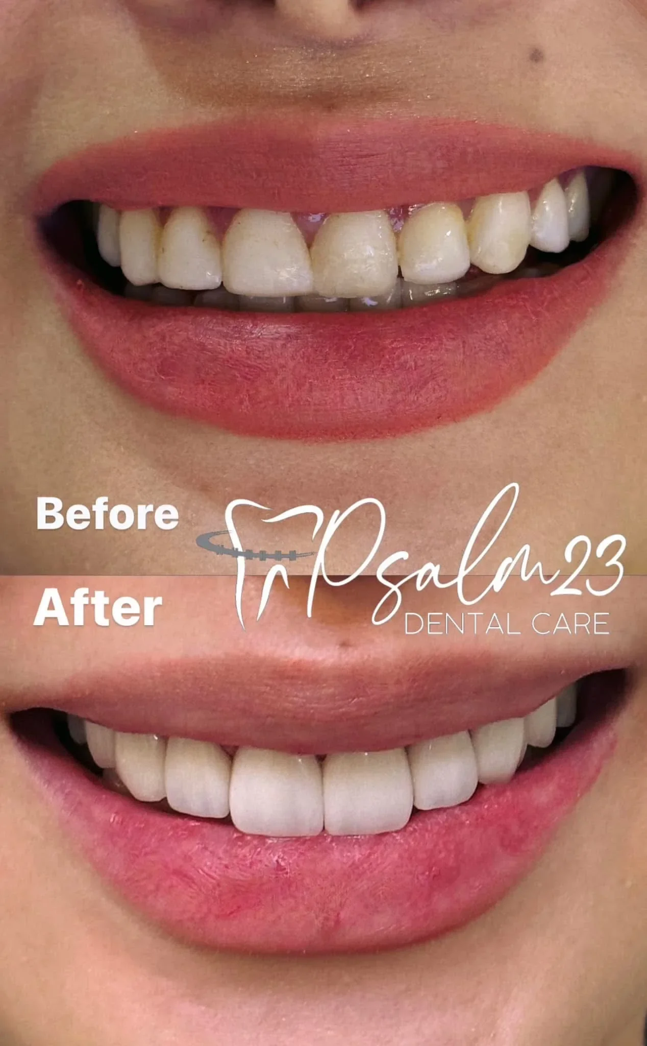 Psalm23 Dental Care cosmetic dentistry services — photo 3